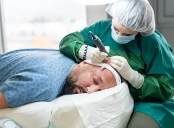 Choisir la meilleure clinique de greffe de cheveux : ces éléments à ne pas négliger